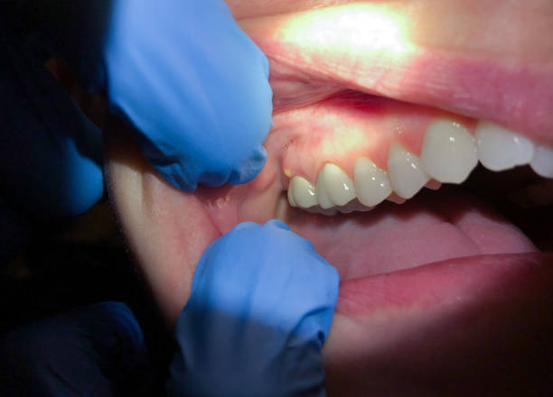 Best Emergency Denture Repair in Andale, KS
